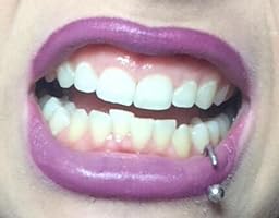 doctor diamond teeth whitening reviews