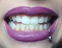 doctor diamond teeth whitening reviews